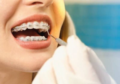 destacada-ortodoncia-dental